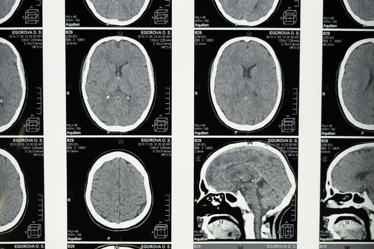 Shilajit Cognitive Benefits: What the Brain Evidence Shows